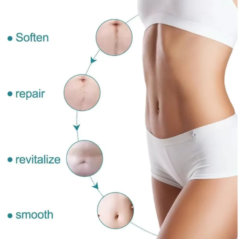 Silicone Scar Sheets