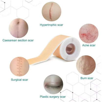 Silicone Scar Sheets